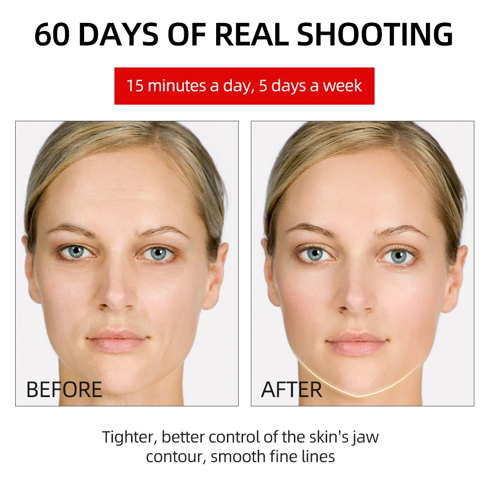 Face Lifting Machine Electric V-Face Shaping Massager Vibration Slimming Double Chin Reducer V-Line Cheek Lift Up Face Slimming