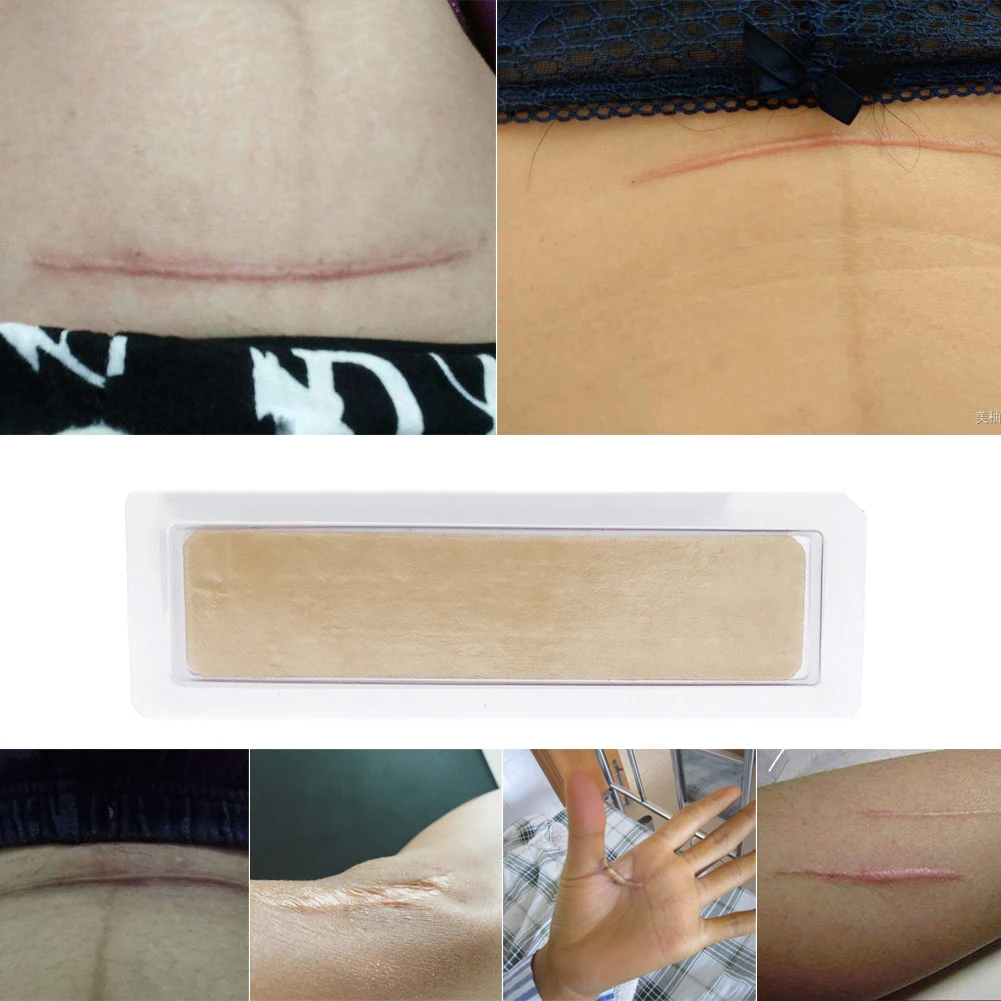 

Maternity Postpartum Self Adhesive Medical Silicone Gel Ultrathin Scar Removal Patch Cesarean Treatment Sheet Waterproof Tape