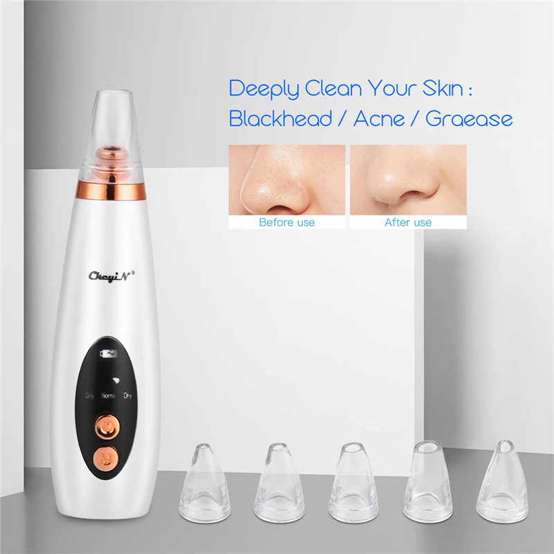 

Face Deep Cleaning Skin Scrubber Microdermabrasion Vacuum Suction Blackhead Remover Facial Pore Cleaner Acne Comedone Extractor