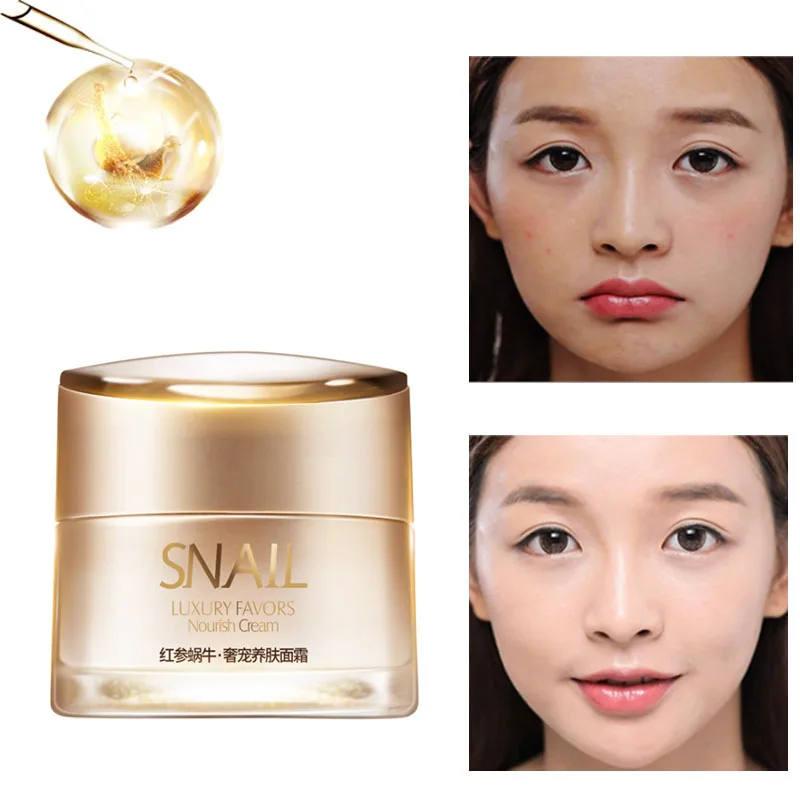 

LAIKOU Snail Cream Pure Collagen Anti Wrinkle Face Cream Anti-Aging Moisturizing Oil Control Whitening Hyaluronic Acid Skin Care