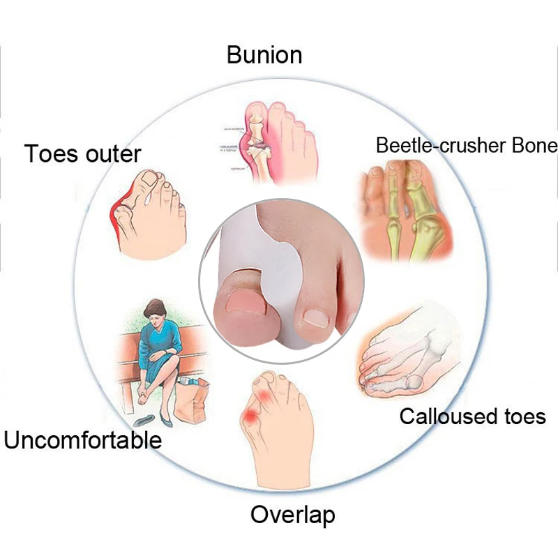 1 шт. инструмент для ухода за ногами Bunion Splint отличный сепаратор пальцев ног