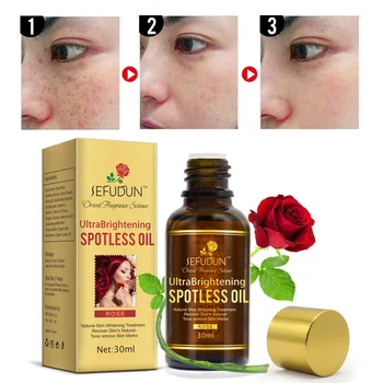 

Rose Whitening Facial Oil Moisturizing Lightening Pigment Anti-freckle Essential Oil