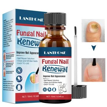

2019 Gentle Care Enhanced Nail Repair Liquid Fangal Nail Renewal Liquid for Finger and Toe Nail