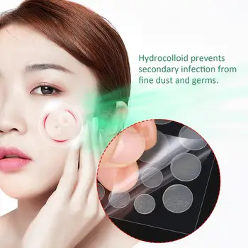 

Hot COSRX Acne Pimple Master Patch 24 Patches Face Skin Care Anti Acne Pimple Treatment Blemish Acne Remover facial Drop ship