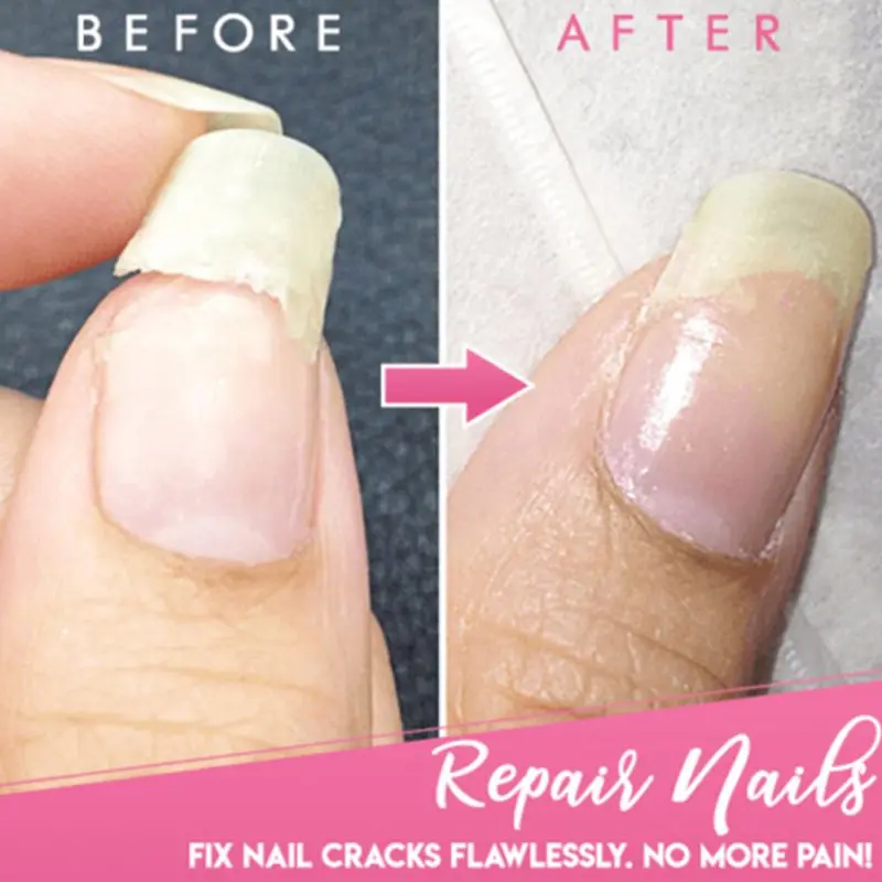 Nail Glue Cracked Nail Repair Gel Strengthen Long Lasting Harmless UV Acrylic Broken Nails Gel