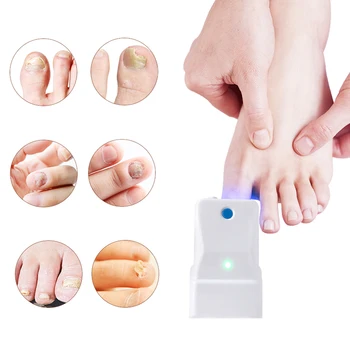

LASPOT Nail Fungus Laser Device for Toe Nail Fungus Remover Anti Fungal Infection Treatment Onychomycosis Repair Health Care