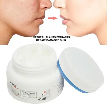 

30g Face Skin Whitening Cream Spots Fading Anti Freckle Removal Cream