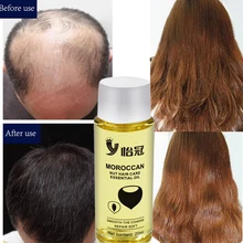 20ml óleo de argan cuidados capilares essência rápido poderoso crescimento do cabelo produtos de perda de cabelo líquido soro reparação cuidados com a queratina do cabelo