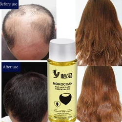 20ml Argan Oil Hair Care Treatment Essence Fast Powerful Hair Growth Liquid Hair Loss Products Serum Repair Hair Keratine Care