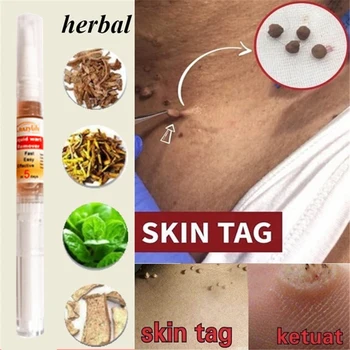

1 Piece Ultra Strength Skin Tag Remover Pen Skin Repair Pen Medical Foot Corn Skin Tag Mole & Genital Wart Remover