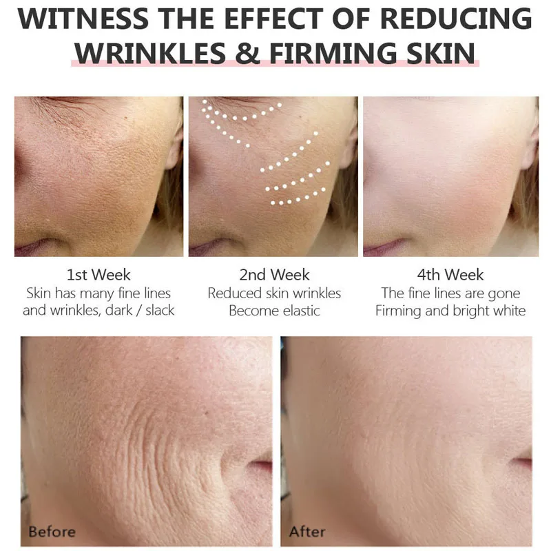 VIBRANT GLAMOUR Retinol Serum Anti Wrinkle Firming Lifting Improve Fine Lines Brighten Whiten Shrink Pores Anti Aging Skin Care