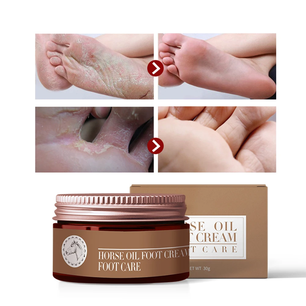 

Horse Oil Foot Cream Moisturizing Itch Repair Relieving Skin Foot Cream Antifungal Peeling Feet Double Care Preventing Chilblain