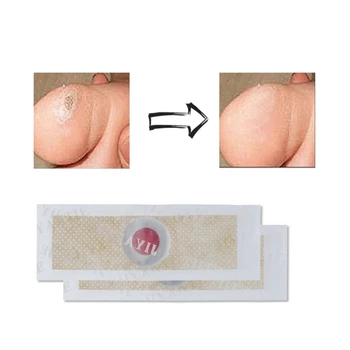 

36Pcs Foot Pain Relieving Corn Plaster Removal Sticker Patch /Plaster