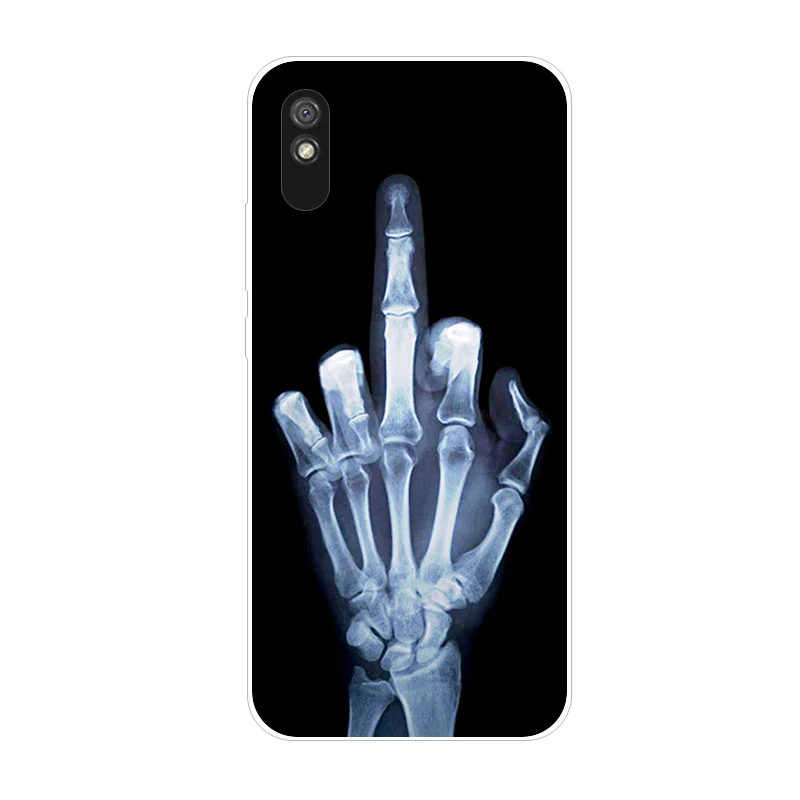 Soft Silicone Back Cover Case - 6.53 Premium Phone Protection