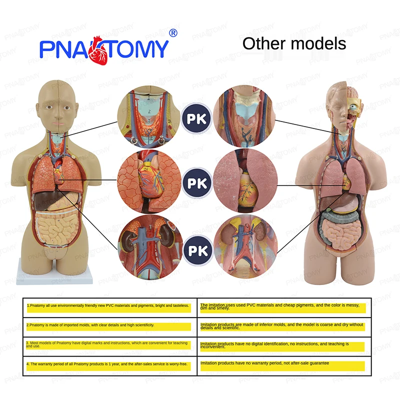 Tireóide Modelo Doente Glândula Anatomia Humana Médica Ensino Equipamento Educacional Patológico 6 Tireóide modelo doente glândula tireóide anatomia humana