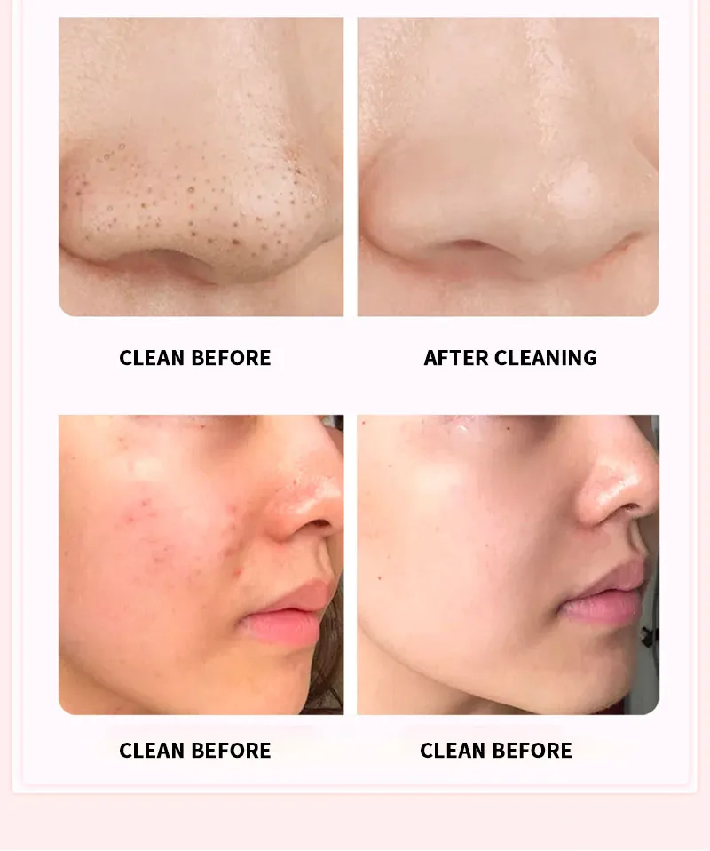 13782670241_1718317712