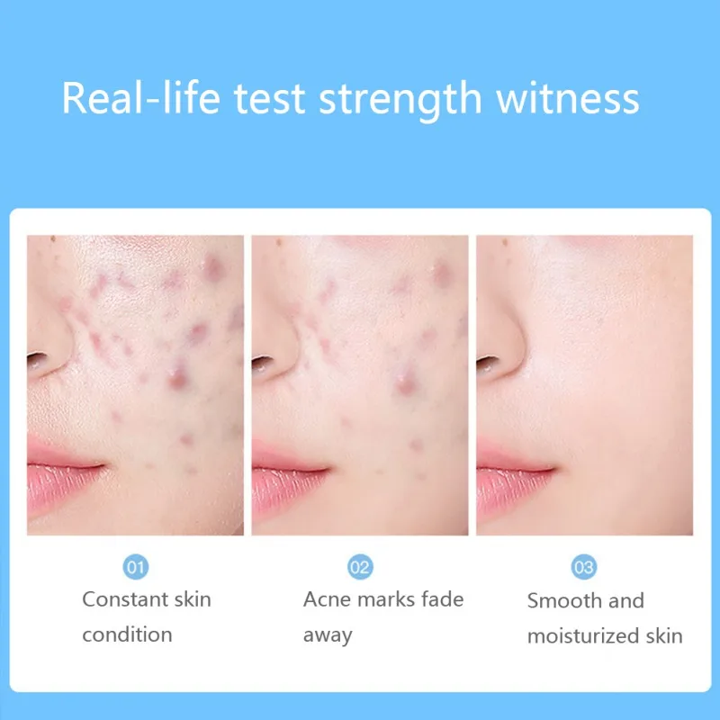 Hot Sale Soap Oil-control Moisturizing Anti-mites Anti-acne Face Body Cleansing Soap