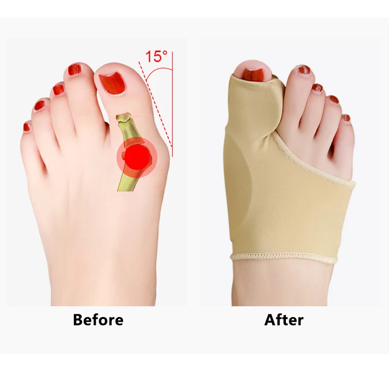 2Pcs Toe Separator Hallux Valgus Corrector Bunions Valgus Haluksy Finger Separator Haluksy For Toes Bunion Corrector
