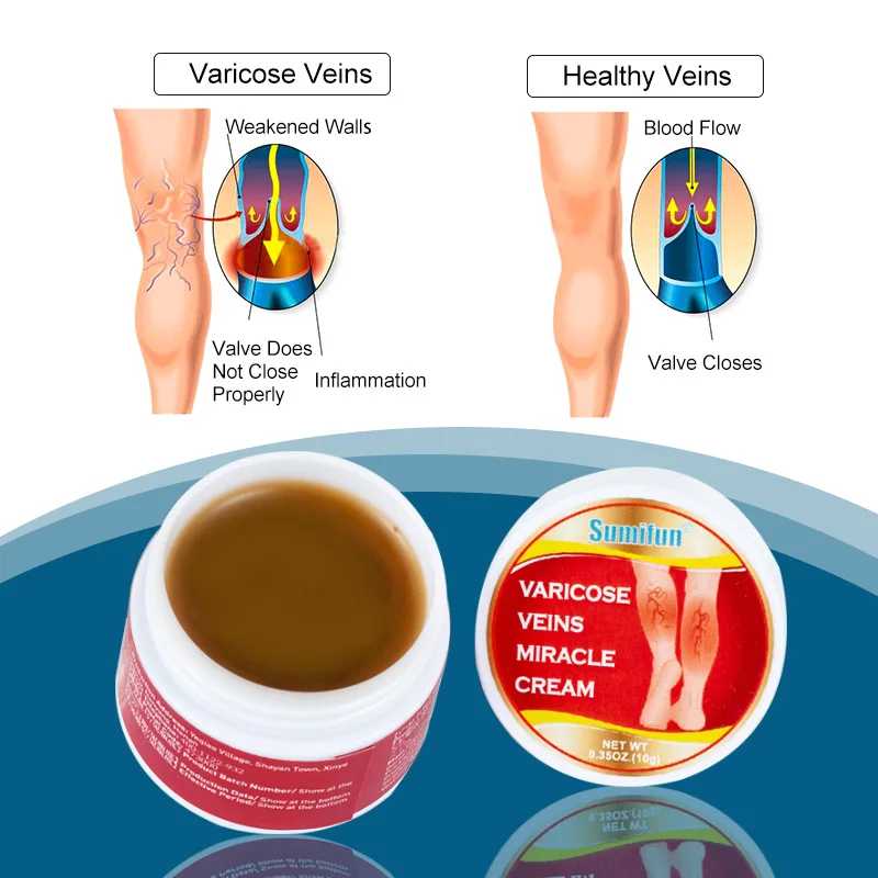 1 قطعة الدوالي كريم علاج التهاب الأوعية الدموية ال...