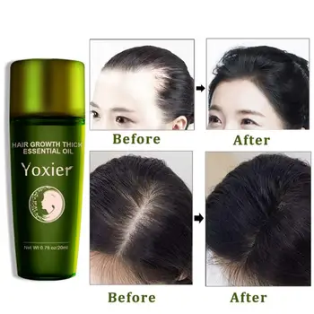 

20ml Herbal Hair Growth Essential Oil Shampoo Hair Care Hair Loss Treatment Thick Fast Repair Growing Treatment Liquid