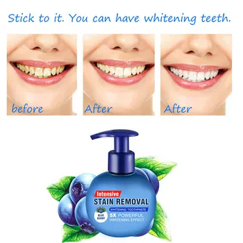 

Push Type Fruity Gums Toothpaste Protection Flavor Refresh Stain Removal Teeth Bleach Daily Bottled Toothpaste Oral Care