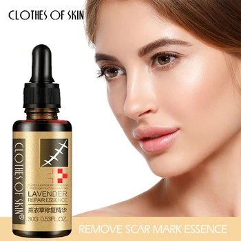 

Lavender Remove Scar mark Essence Acne Scar Stretch Marks Hyaluronic acid Skin Repair Product Acne Spots Acne Treatment