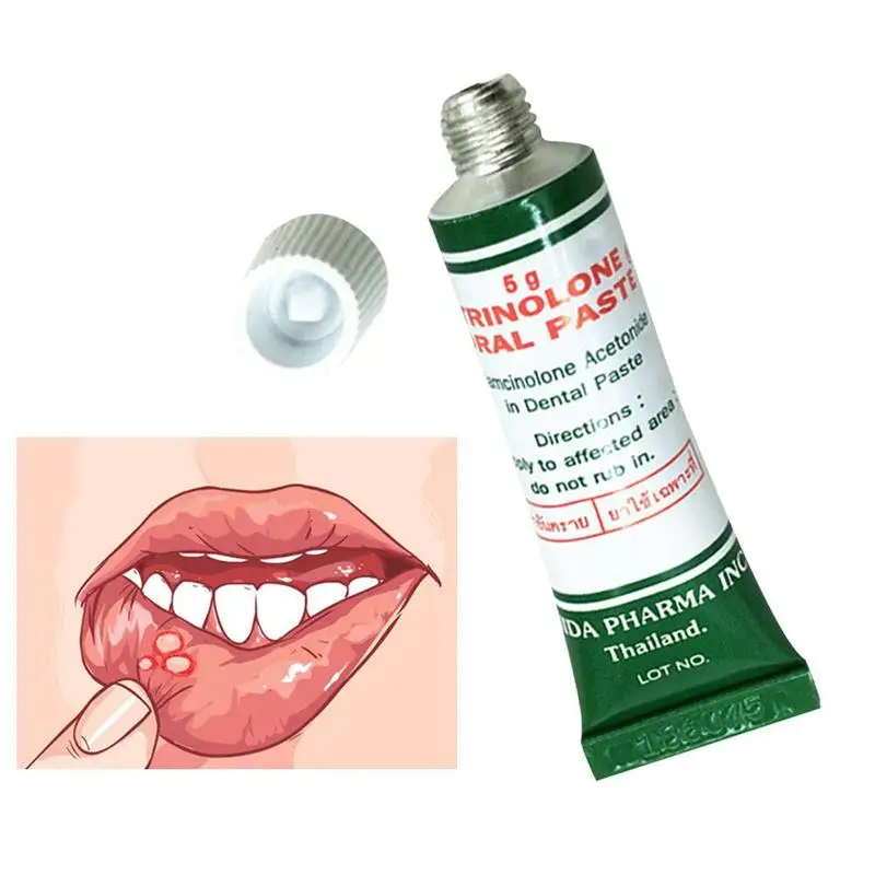 

3CT004 Fast Mouth Pain Relief Ulcer Relief Gel Natural Herbal Oral Antibacterial Cream Fast Relief from Severe Pain & Irritation
