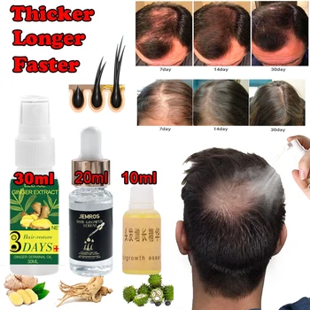 

30/20/10 ML Ginger Fast Hair Growth Oil Hair Loss Treatment Scalp Repair Essence Men Women Hair Extension Oil Hair Care Products