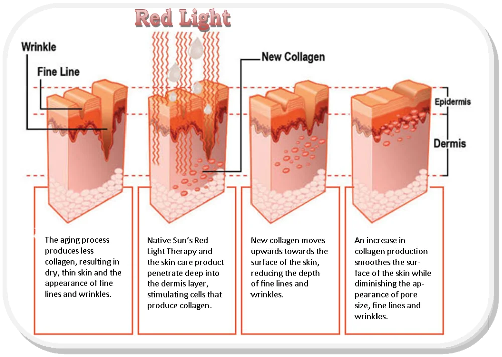 red_light_skin