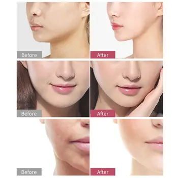 

New V Face Lifting Instrument Masseter Double Chin Removal Color Light Skin Care Skin Tightening V Line Face Lift Belt