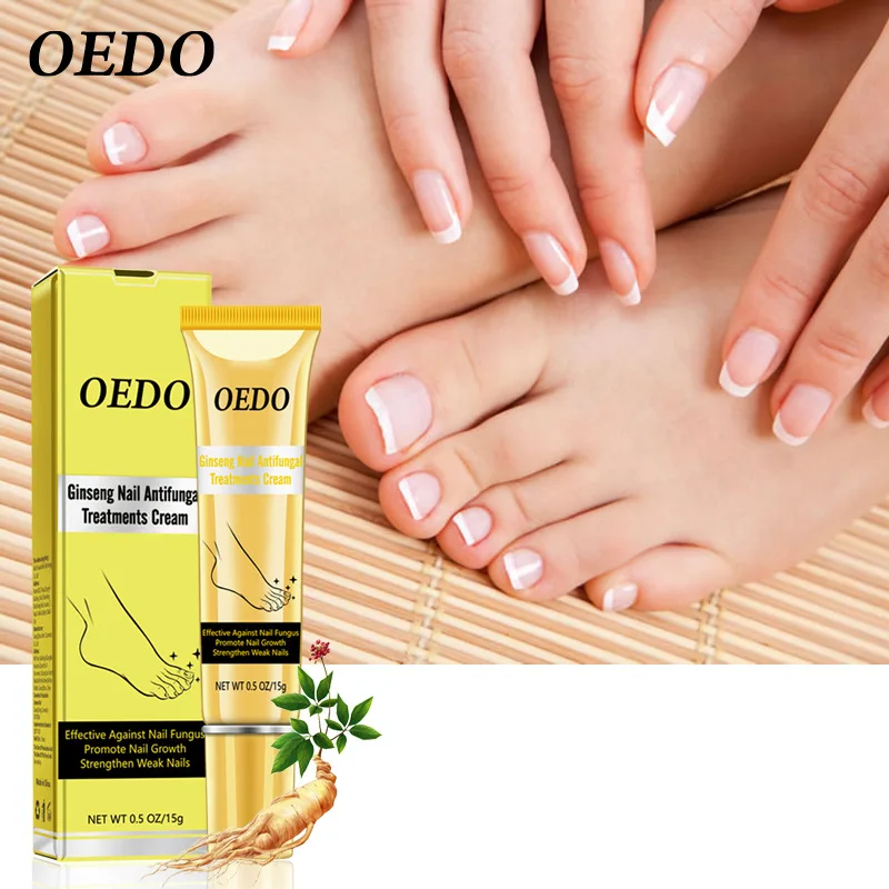 Ginseng Nail Antifungal Treatments Cream Herbal Removal Nail Fungus Toe