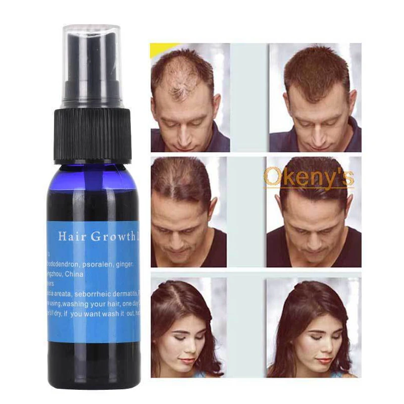 30ml Fast Hair Growth Essence Oil Spray Hair Grow Restoration Prevent Baldnessast Grow Dense Restoration Hair Loss Product