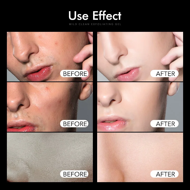 Men S Clean Exfoliating Gel Facial Whitening Peeling Cream Brightening Face Scrub Removal Facial Cleanser For Face Skin Care Aliexpress