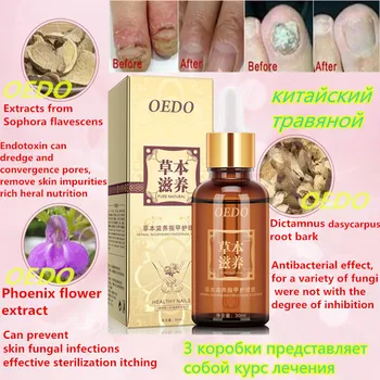 

Herbal Fungal Nail Treatment Essential oil Hand and Foot Whitening Toe Nail Fungus Removal Infection Feet Care Polish Nail Gel