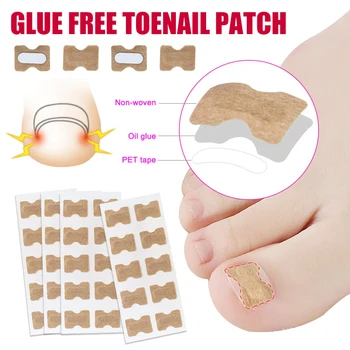 

Foot Care Stickers Toenail Correction Sticker Glue-free for Men Women Professional Pedicure Toenail Care Tool KG66