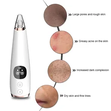 Электронный прибор для вакуумной чистки лица Очиститель черных точек уход за кожей лица Красота машина Очищающий Инструмент для кожи уход