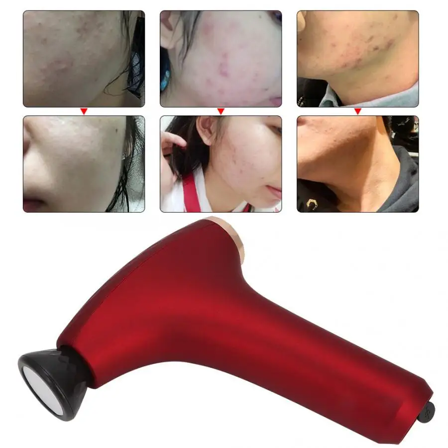 

Laser Hair Removal Machine SKG 3627 Plasma Pimple Treatment Mites Removal Oil Control Moisturizing Facial Skin Care Device Led