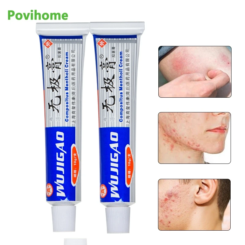2pcs Antipruritic Crean Mosquito Bite Repellents Anti-Itching Ointment Anti-inflammation Eczema Psoriasis Herbal Cream D3195 | Красота и