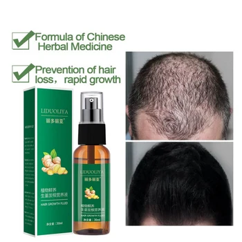 

Ginger Hair Growth Solution Nourish Hair Scalp Anti-fork Hair Regrowth Treatment Product 30ml K1
