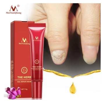

Nail Repair Cream Anti Fungal Nail Chinese Herbal Toe Nail Fungus Treatment Nail Care Herbal