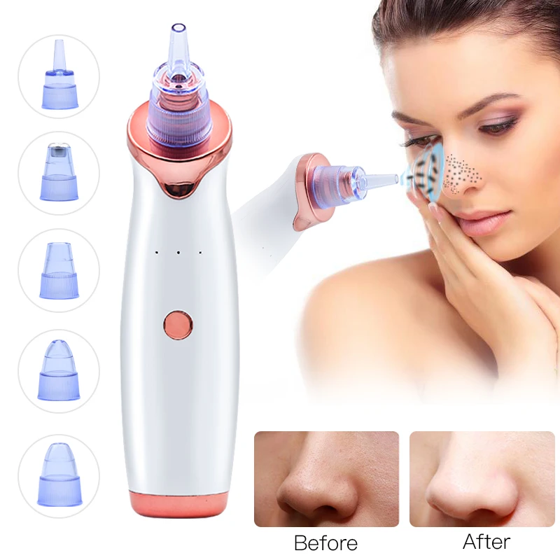 

Face Deep Cleaner Blackhead Removal Pore Acne Cleaning Skin Care Tools Machine Electric Suction Blackhead Removal Instrument