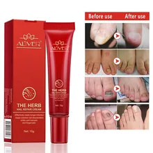 ALIVER средство для восстановления ногтей с пилочкой для ногтей против удаления грибка для ногтей