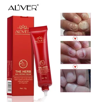 

Amazon ALIVER nail nail nail repair paste grey nail in herbal nail paste
