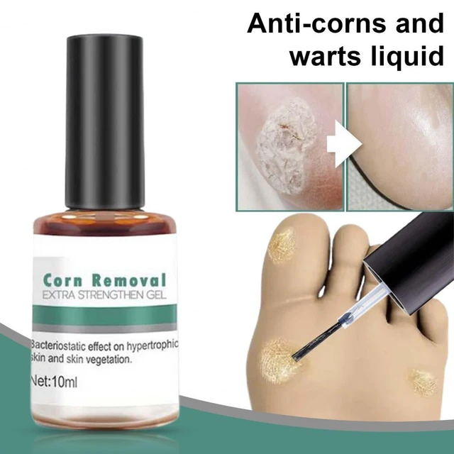 Top more than 129 nail polish on warts best noithatsi.vn