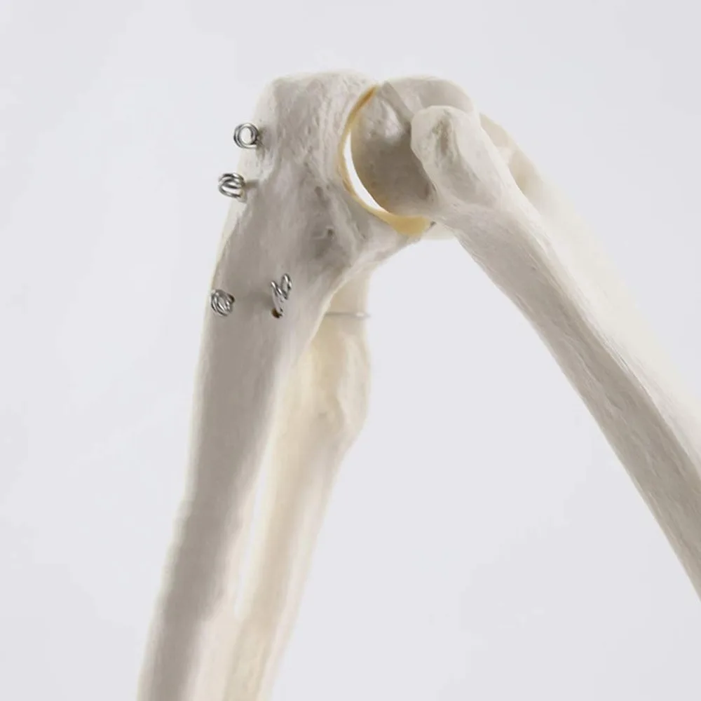 1:1 Human Bone Model of Bone Adult Arm of Upper Limb Arm and Radius Hand Medical Science School Teaching Supplies