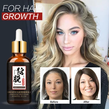 

Anti Hair Loss Treatment Products for Fast Hair Growth Essence Oil Natural Extract Hair Regrowth Hair Care Products Hair Tonic