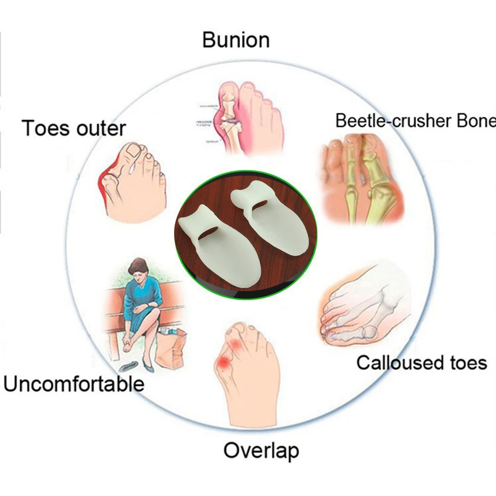 Sumifun 10Pcs Feet Care Silicone Gel Toe Separator Bunion Guard Foot Care Toes Bunion Guard Foot Hallux Valgus Protector C585