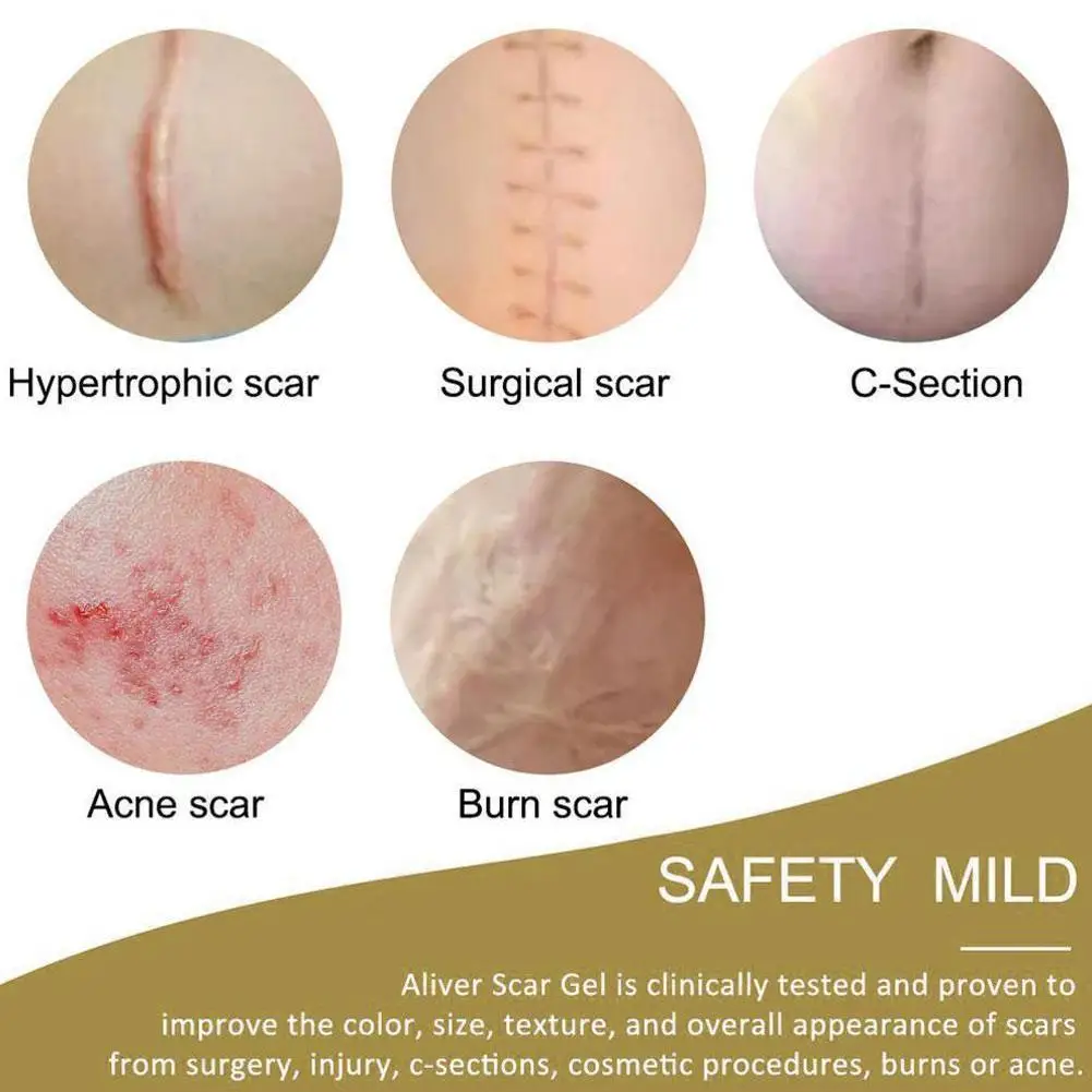 

Scar Concealer Concealing Tape Scars Flaw Cover UP Tape Stickers Skin Color Concealer Flesh-Colored Waterproof Tattoo Flaw T1A0