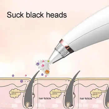 

Electric Pore Cleaner Dead Skin Acne Blackhead Remover Face Cleaning Device Strong adsorption, easy to clean black head, acne .