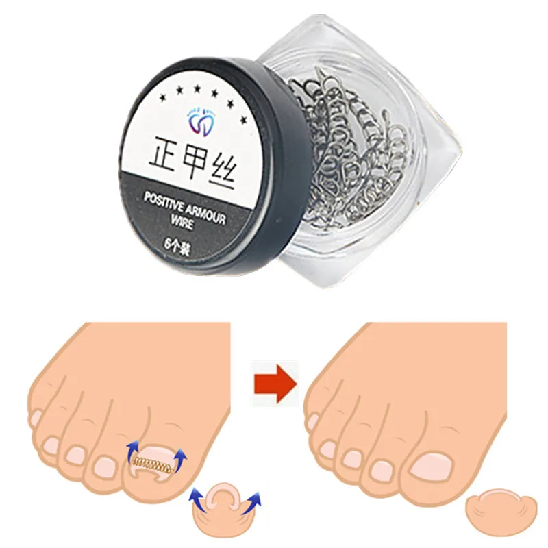 6 шт. коррекция вросших пальцев ног, педикюр, проволока из нержавеющей стали, фиксатор, инструмент для восстановления, коррекция ногтей, инструменты для ухода за ногами